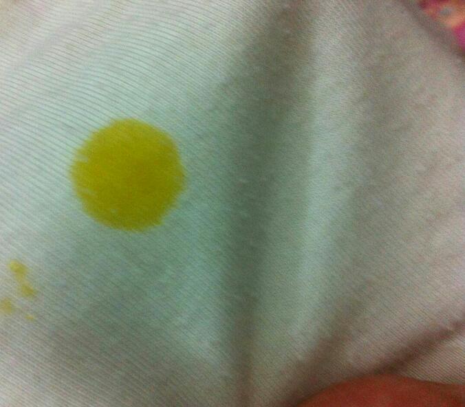 白色工作服油污清洗？